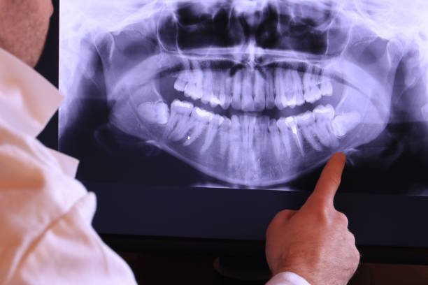 Best Emergency Dentist for Knocked-Out Tooth in Union City, CA