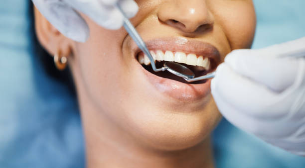 Best Pediatric Emergency Dentist in Union City, CA