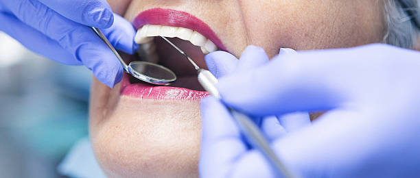 Best Emergency Dentist for Lost Fillings or Crowns in Union City, CA